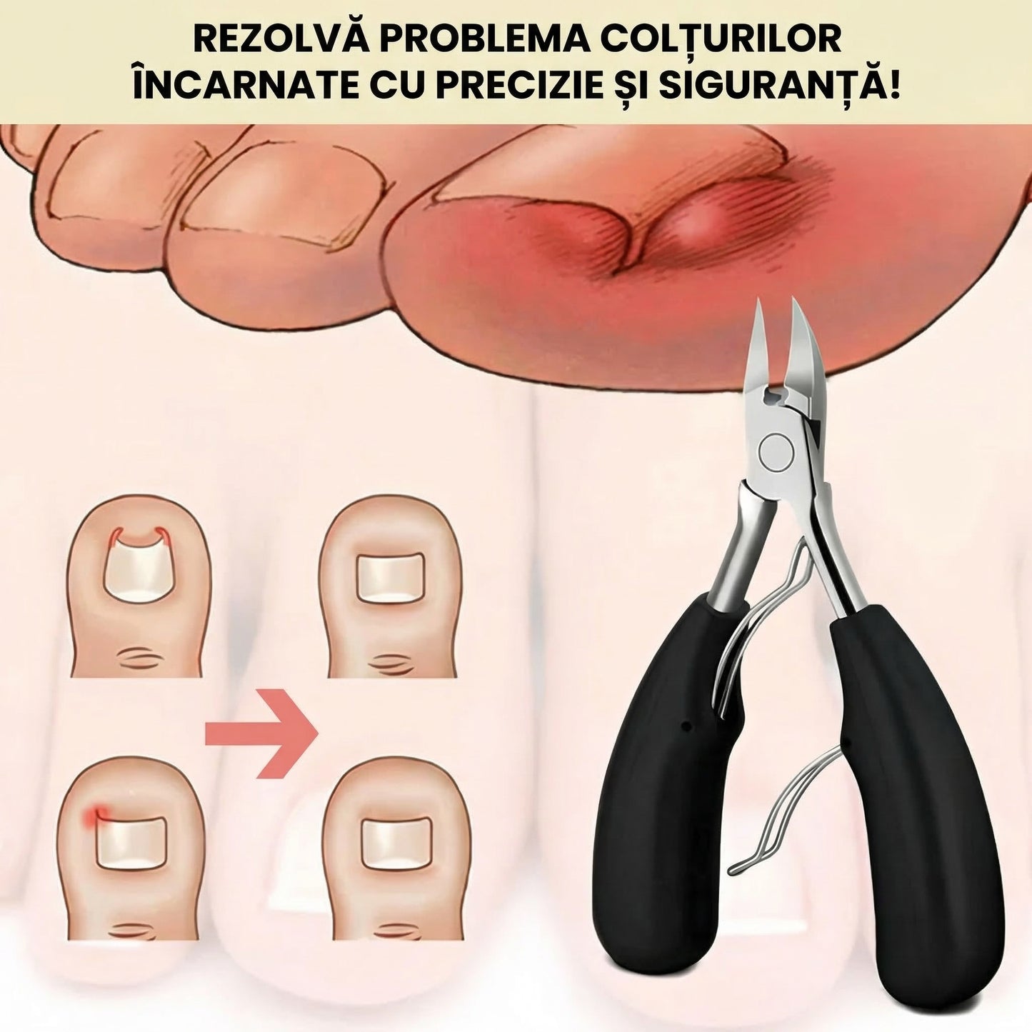 Trusă pentru Unghii Groase și Încarnate
