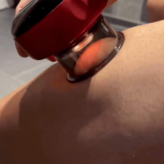 Aparat Electric cu Ventuze pentru Masaj